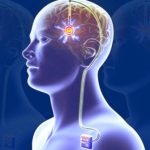 Deep Brain Stimulation Devices market