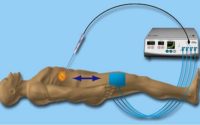 Ablation System Devices Market