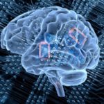 Brain Implants Market - TechSci Research