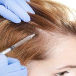Alopecia Treatments Market