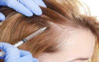 Alopecia Treatments Market