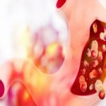 Gastric Cancer Therapeutics Market - TechSci Research