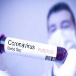 Coronavirus Diagnostics Market