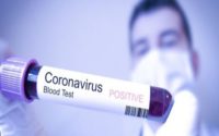 Coronavirus Diagnostics Market