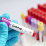 Malaysia Coronavirus Testing Kits