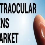 United States Intraocular Lens (IOLs) Market