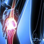 Orthopedic Digit Implants Market - TechSci Research